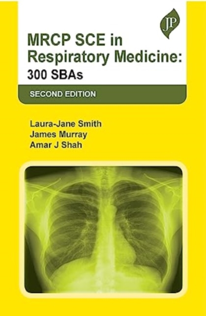 MRCP SCE in Respiratory Medicine : 300 SBAs, Paperback / softback Book