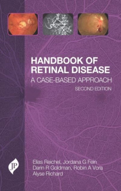 Handbook of Retinal Disease : A Case-Based Approach, Paperback / softback Book