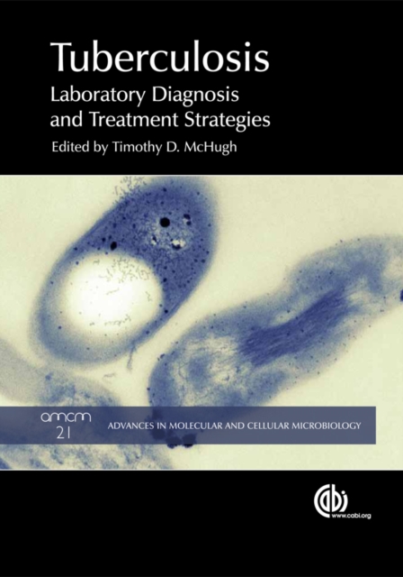 Tuberculosis : Laboratory Diagnosis and Treatment Strategies, EPUB eBook