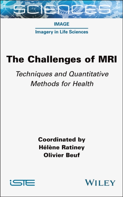 The Challenges of MRI : Techniques and Quantitative Methods for Health, Hardback Book