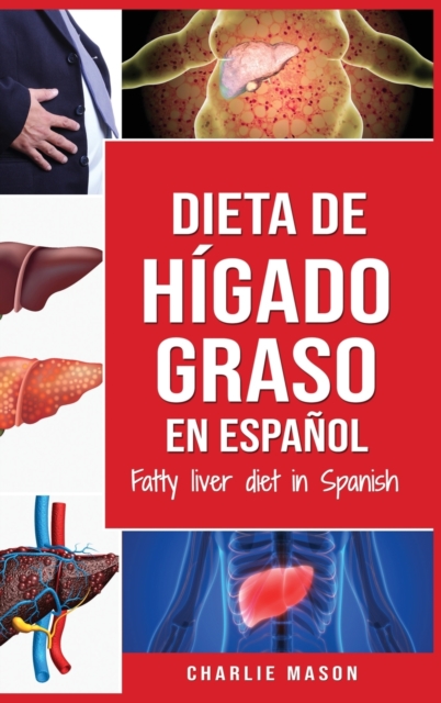 Dieta de higado graso en espanol/Fatty liver diet in Spanish, Hardback Book
