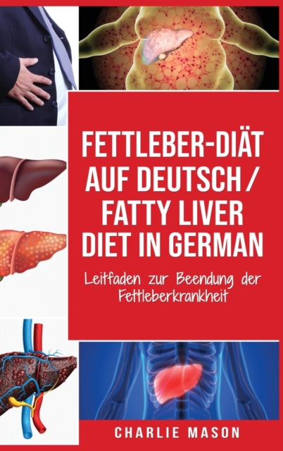 Fettleber-Diat Auf Deutsch/ Fatty liver diet In German : Leitfaden zur Beendung der Fettleberkrankheit, Hardback Book