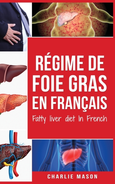 Regime de foie gras En francais/ Fatty liver diet In French : Guide sur la facon de mettre fin a la maladie du foie gras, Hardback Book