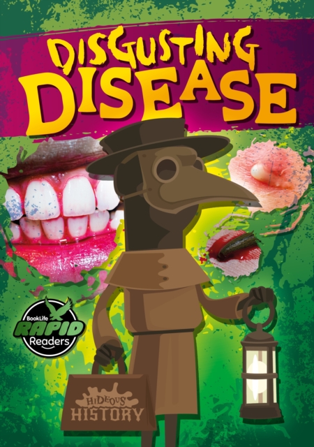 Disgusting Disease, Paperback / softback Book