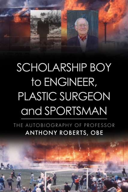 Scholarship Boy to Engineer, Plastic Surgeon and Sportsman, Hardback Book
