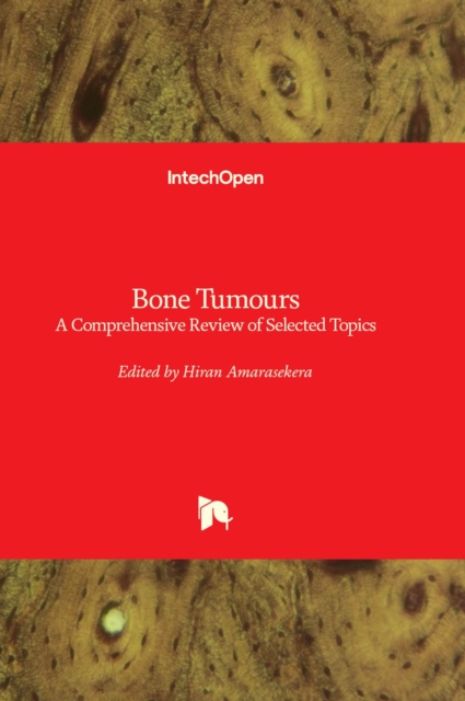 Bone Tumours : A Comprehensive Review of Selected Topics, Hardback Book