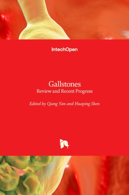 Gallstones : Review and Recent Progress, Hardback Book