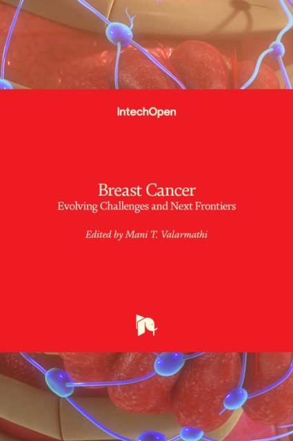 Breast Cancer : Evolving Challenges and Next Frontiers, Hardback Book