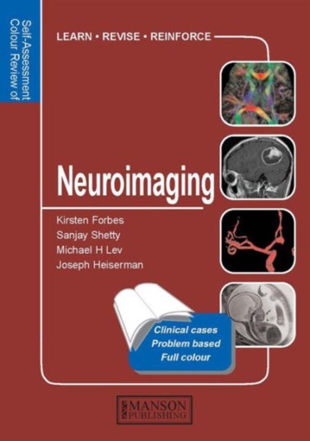 Neuroimaging : Self-Assessment Colour Review, Paperback / softback Book