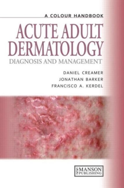 Acute Adult Dermatology : Diagnosis and Management: A Colour Handbook, Paperback / softback Book