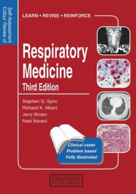 Respiratory Medicine : Self-Assessment Colour Review, Third Edition, Paperback / softback Book