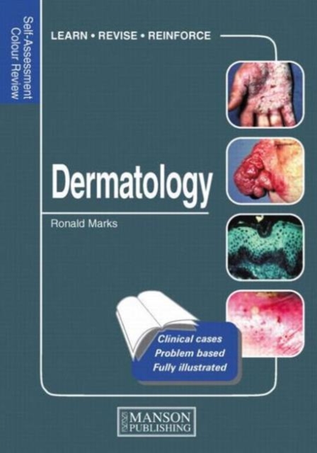 Dermatology : Self-Assessment Colour Review, Paperback / softback Book