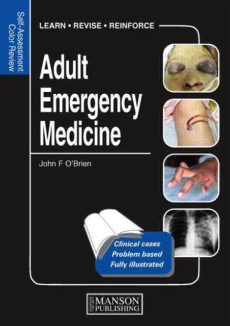 Adult Emergency Medicine : Self-Assessment Color Review, Paperback / softback Book