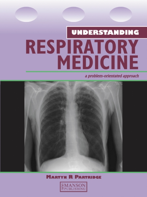 Understanding Respiratory Medicine : A Problem-Oriented Approach, PDF eBook