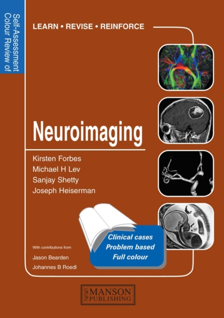 Neuroimaging : Self-Assessment Colour Review, PDF eBook