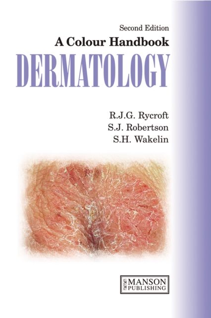Dermatology : A Colour Handbook, Second Edition, PDF eBook