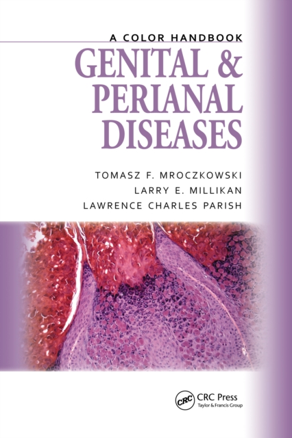 Genital and Perianal Diseases : A Color Handbook, PDF eBook