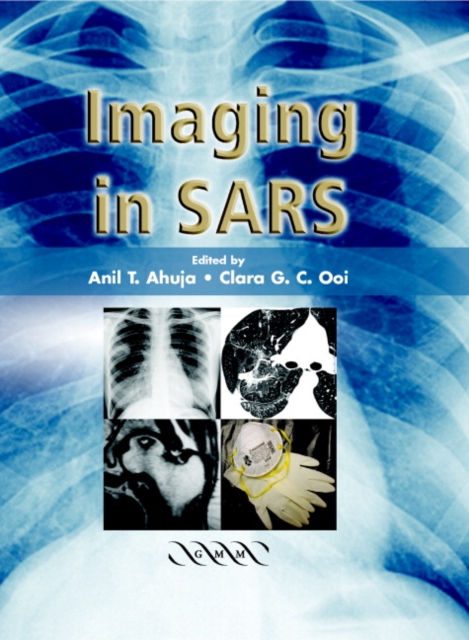 Imaging in SARS, Hardback Book