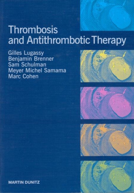 Thrombosis and Anti-Thrombotic Therapy, Paperback / softback Book