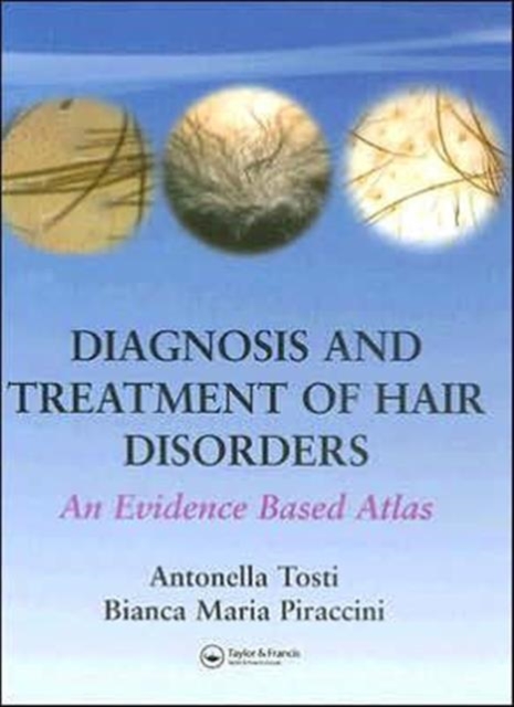 Diagnosis and Treatment of Hair Disorders : An Evidence-Based Atlas, Hardback Book