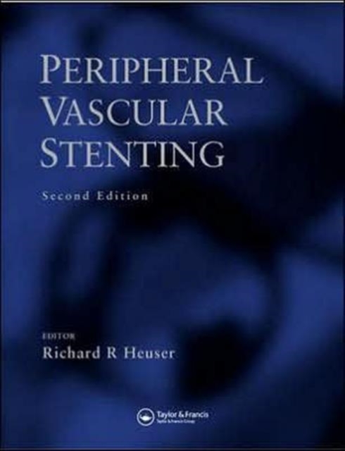 Peripheral Vascular Stenting, Second Edition, Hardback Book