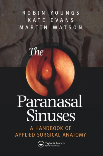 The Paranasal Sinuses, Hardback Book