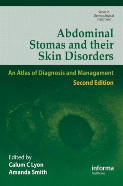 Abdominal Stomas and Their Skin Disorders, Hardback Book