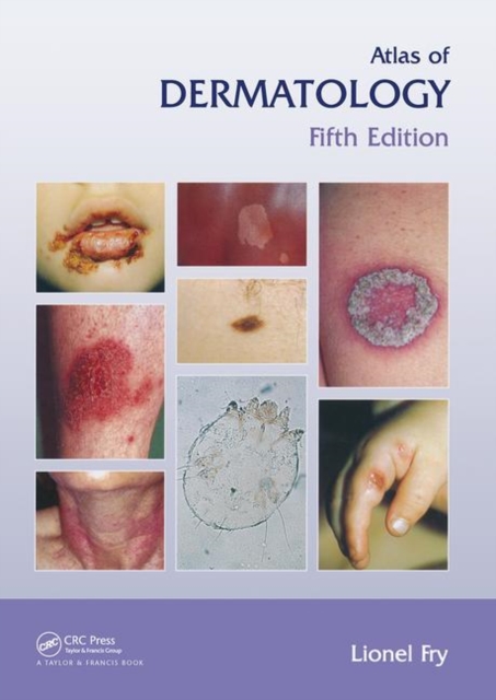 Atlas of Dermatology, Fifth Edition, Hardback Book