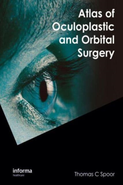 Atlas of Oculoplastic and Orbital Surgery, Hardback Book