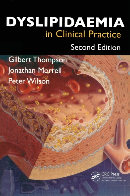 Dyslipidaemia in Clinical Practice, Paperback / softback Book
