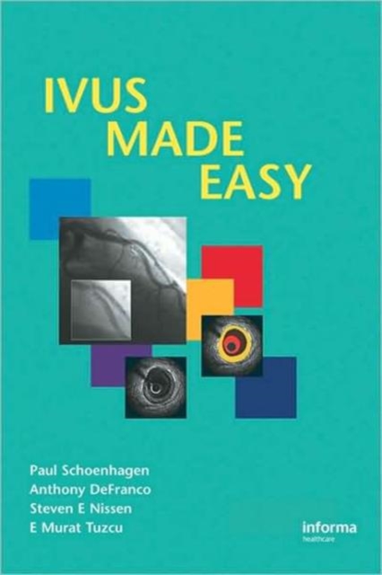 IVUS Made Easy, Paperback / softback Book