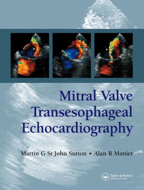Mitral Valve Transesophageal Echocardiography, Hardback Book