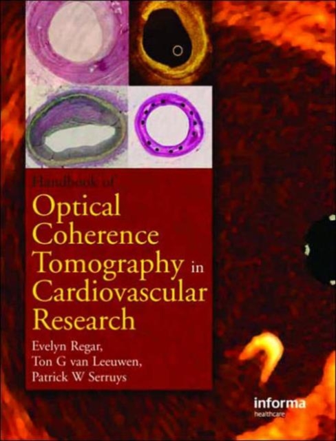 Optical Coherence Tomography in Cardiovascular Research, Hardback Book