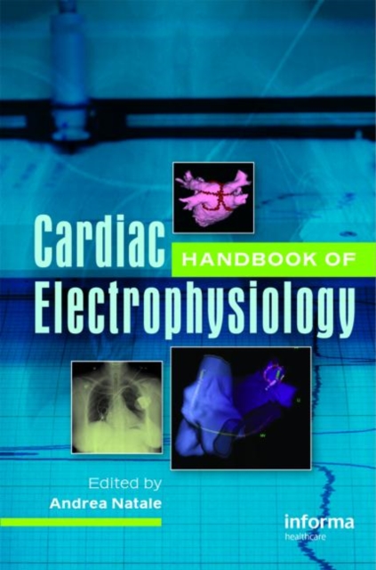 Handbook of Cardiac Electrophysiology, Hardback Book