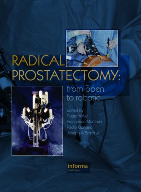 Radical Prostatectomy : From Open to Robotic, Hardback Book
