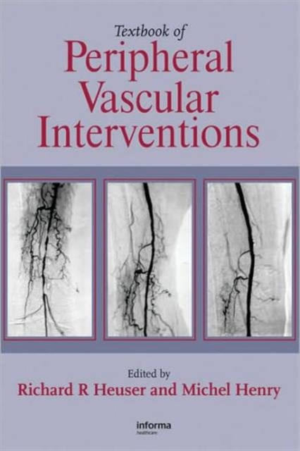 Textbook of Peripheral Vascular Interventions, Hardback Book