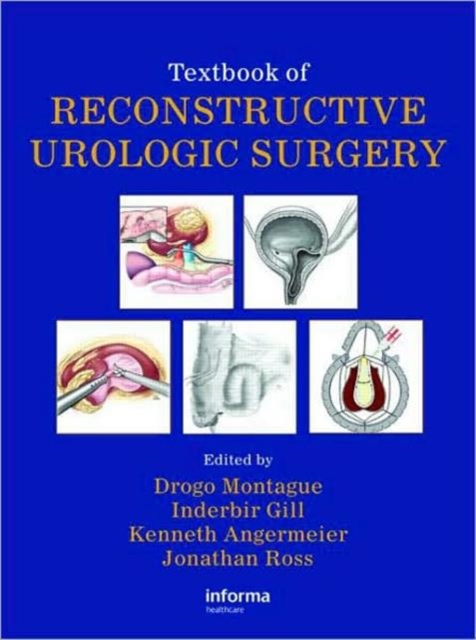 Textbook of Reconstructive Urologic Surgery, Hardback Book