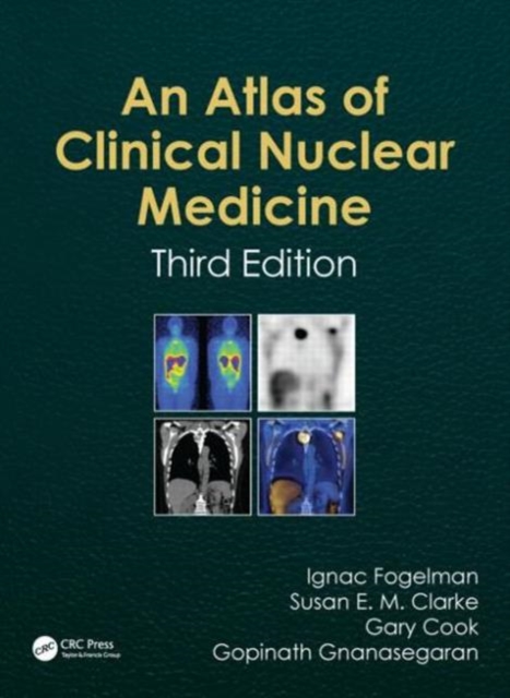 Atlas of Clinical Nuclear Medicine, Hardback Book