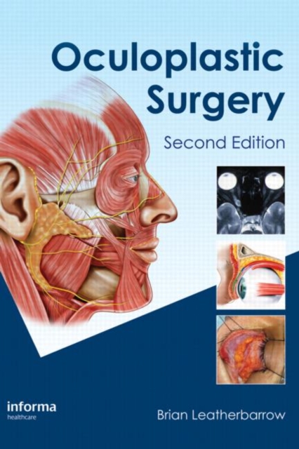 Oculoplastic Surgery, Hardback Book