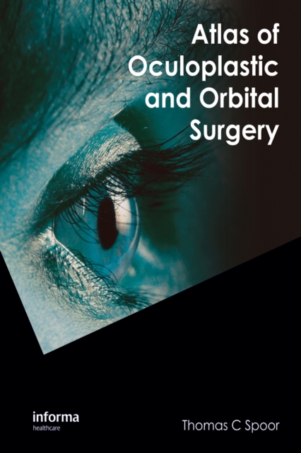 Atlas of Oculoplastic and Orbital Surgery, PDF eBook