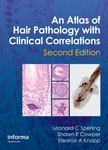 An Atlas of Hair Pathology with Clinical Correlations, PDF eBook