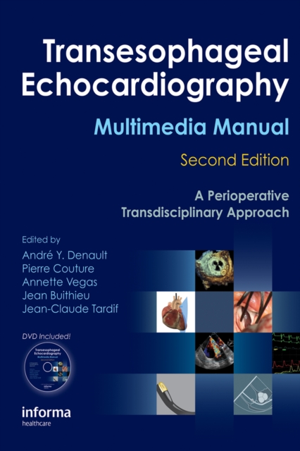 Transesophageal Echocardiography Multimedia Manual : A Perioperative Transdisciplinary Approach, PDF eBook