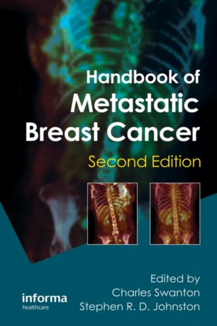 Handbook of Metastatic Breast Cancer, Hardback Book