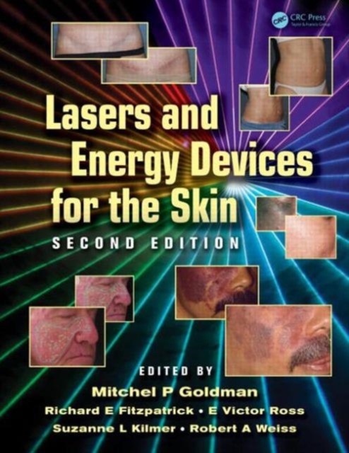 Lasers and Energy Devices for the Skin, Hardback Book