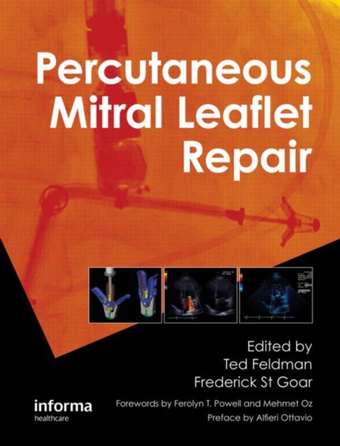 Percutaneous Mitral Leaflet Repair : MitraClip Therapy for Mitral Regurgitation, Hardback Book