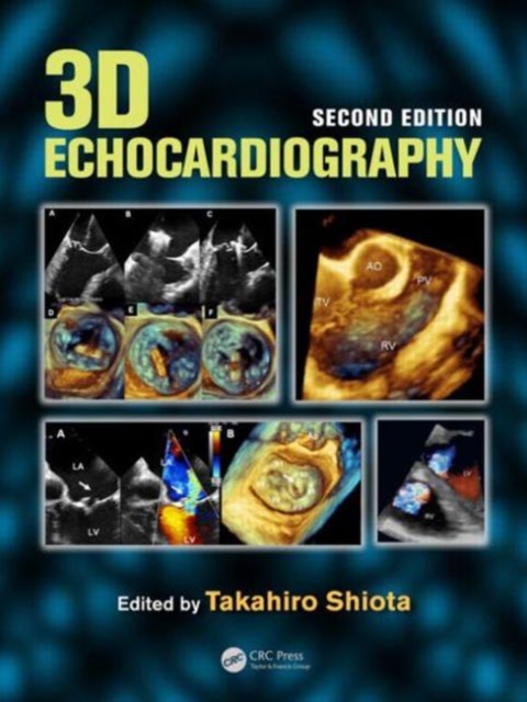 3D Echocardiography, Mixed media product Book