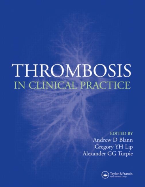 Thrombosis in Clinical Practice, Hardback Book