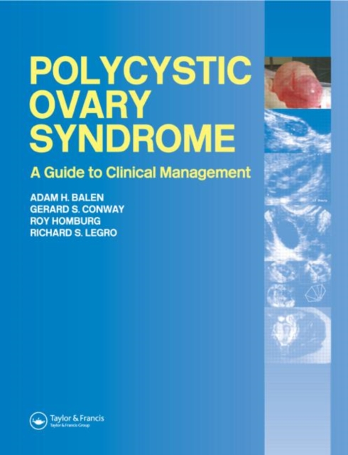 Polycystic Ovary Syndrome : A Guide to Clinical Management, Hardback Book