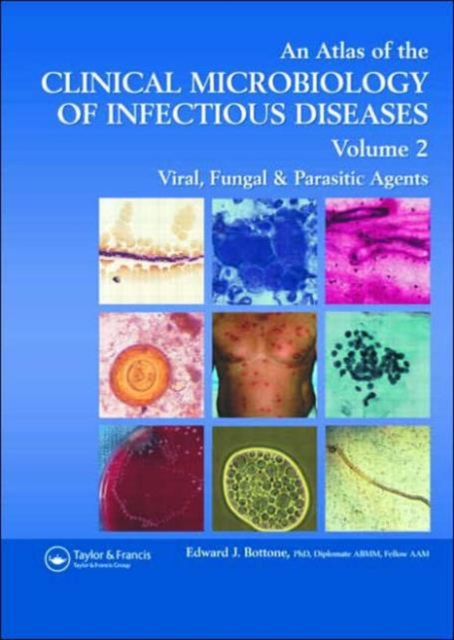 Atlas of the Clinical Microbiology of Infectious Diseases : Viral, Fungal and Parasitic Agents, Hardback Book