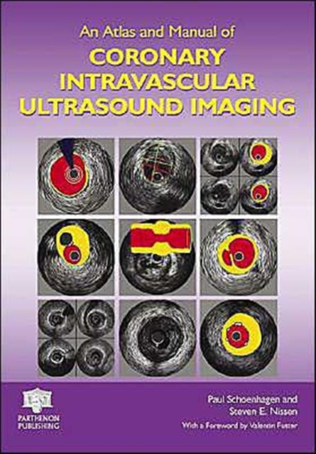 An Atlas and Manual of Coronary Intravascular Ultrasound Imaging, Hardback Book
